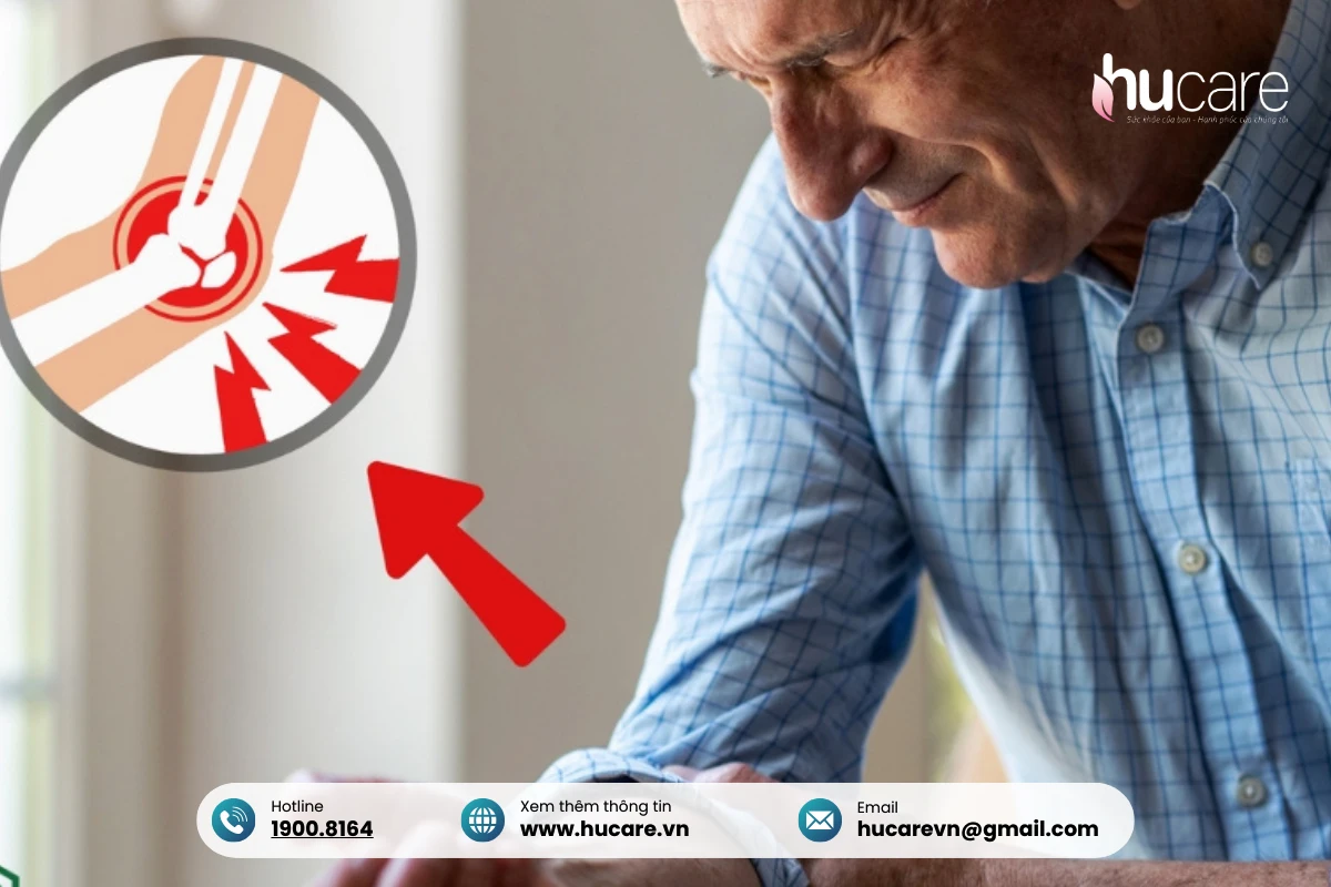 Viêm Khớp Chủ Yếu Do Thoái Hóa Khớp Gây Nên